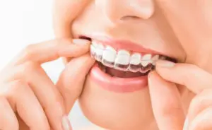Orthodontics in Virginia Beach, VA
