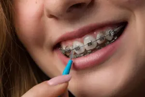 Oral Hygiene