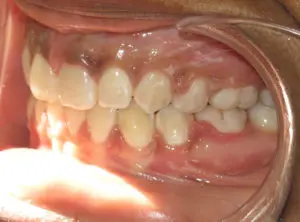 Surgery Before and After Pictures in Virginia Beach, VA