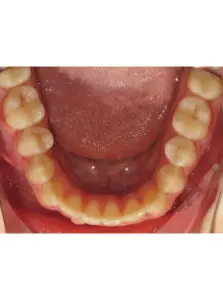 Surgery Before and After Pictures in Virginia Beach, VA