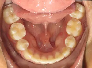 Surgery Before and After Pictures in Virginia Beach, VA