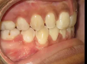 Surgery Before and After Pictures in Virginia Beach, VA