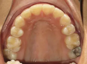 Surgery Before and After Pictures in Virginia Beach, VA