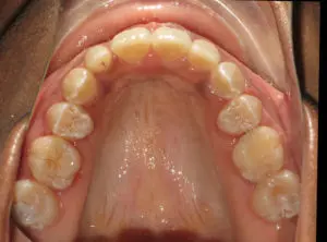 Surgery Before and After Pictures in Virginia Beach, VA