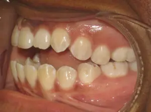 Surgery Before and After Pictures in Virginia Beach, VA