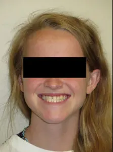 Surgery Before and After Pictures in Virginia Beach, VA