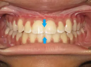 Surgery Before and After Pictures in Virginia Beach, VA