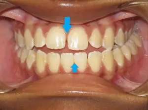 Surgery Before and After Pictures in Virginia Beach, VA