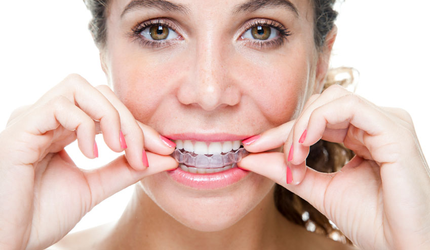 What You Should And Shouldn T Do When You Have A Retainer