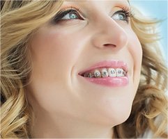 Orthodontist in Virginia Beach & Onley, VA