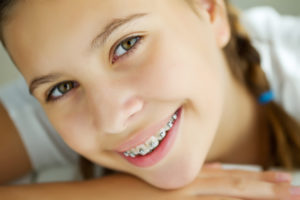 Accelerated Orthodontics in Virginia Beach, VA