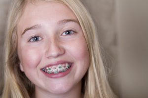 Braces for Kids in Virginia Beach, VA