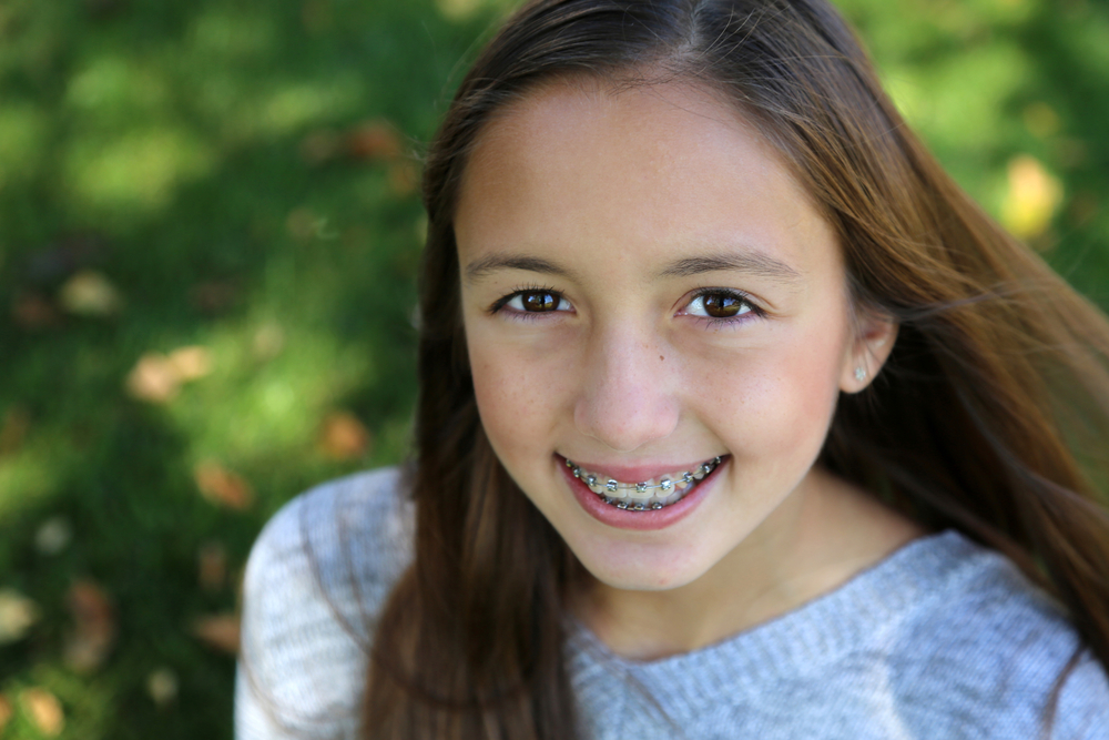 Cost of Braces Virginia Beach, VA Norfolk Cost of Braces
