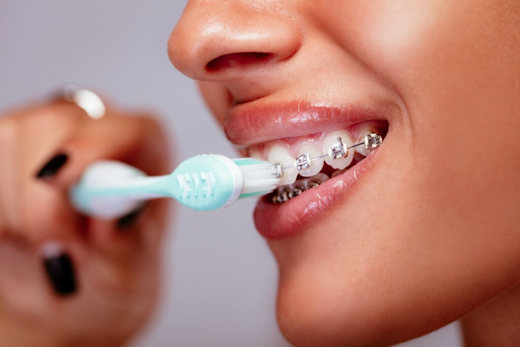 Top 7 Questions to Ask Your Orthodontist Before Starting Treatment