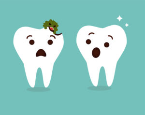 Cavity causes. White spots on teeth causes