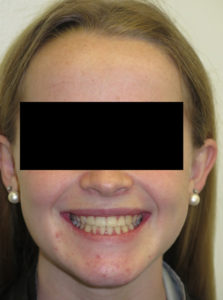 Surgery Before and After Pictures in Virginia Beach, VA