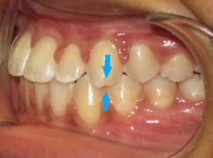 Surgery Before and After Pictures in Virginia Beach, VA