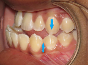 Surgery Before and After Pictures in Virginia Beach, VA